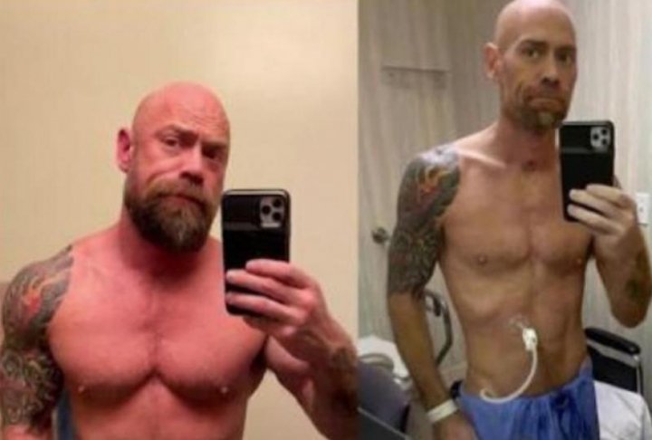 Transformarea incredibilă pe care a suferit-o un bărbat infectat cu coronavirus timp de 6 săptămâni: "Mă simțeam atât de slăbit" (FOTO)