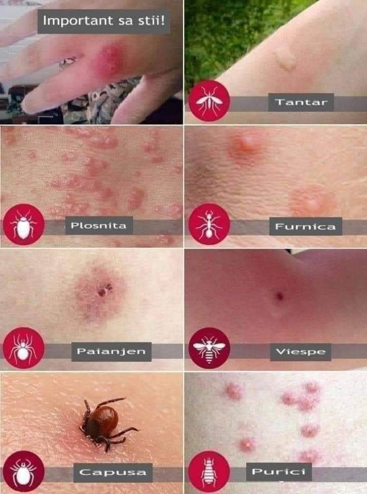 Dicționarul înţepăturilor de insecte. Cum recunoști rănile provocate de căpușe, păianjeni, purici, țânțari sau ploșnițe (FOTO)