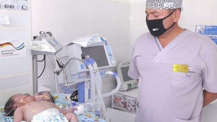 O femeie din Samarkand a născut un copil cu două capete. Medicii sunt uluiţi