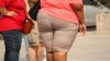 Studiu: Obezitatea crește riscul de deces în cazul pacienților cu COVID-19