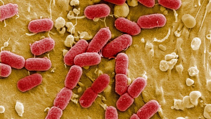 Semnal de alarmă al OMS. Superbacteriile ar putea ucide milioane de oameni până în 2050