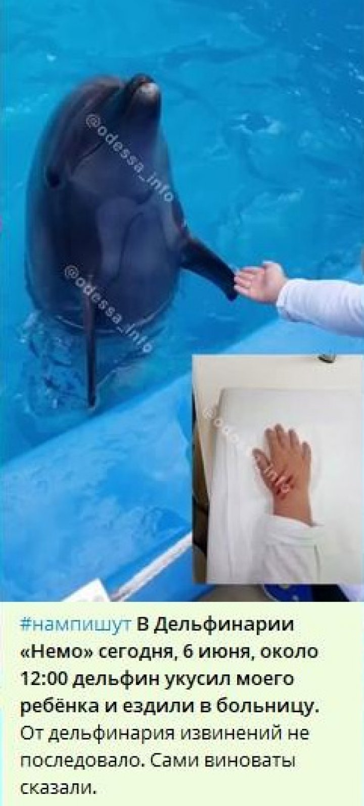 CAZ ŞOCANT în Odesa. Un COPIL a ajuns la spital, după ce a fost ATACAT DE UN DELFIN (FOTO/VIDEO)