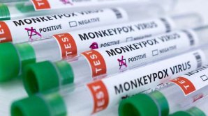În Moldova a fost înregistrat primul caz de variola maimuței. Pacientul este din SUA