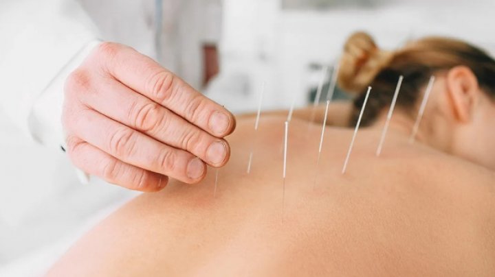 Acupunctură, terapie manuală, fitoterapie. Cetățenii vor putea beneficia în continuare de asistență medicală la Centrul de Medicină Tradițională Chineză