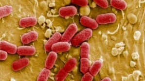 Немцы обнаружили источник кишечной палочки. Узнай, о каком продукте идет речь