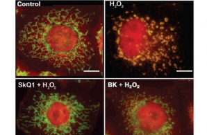 Российские ученые ведут разработки препарата, замедляющего процессы старения