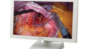 Sony выпустила первый в мире OLED-дисплей в помощь хирургам