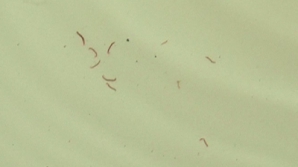 Из кранов жителей Ниспорен течет червивая вода. У властей нет этому объяснения