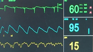 В Молдове отмечается рост смертности от инфаркта миокарда