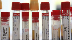 Японские ученые разработали устройство по быстрой диагностике гриппа