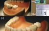 Информацию о здоровье человека будут собирать встроенные в зубы чипы