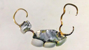 Ювелирные зубы: археологи обнаружили протез работы Фаберже