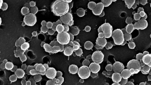 Качество воды водоемов страны ухудшилось из-за высоких температур 