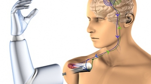 Американский школьник сконструировал протез, контролируемый мозгом человека