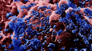 Первая смерть от птичьего гриппа H5N1 зафиксирована в Канаде