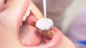 ВОЗ: восемь из десяти жителей Молдовы страдают кариесом 