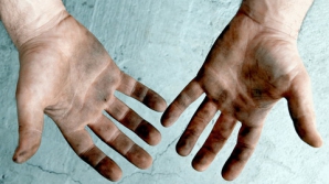  С начала года в стране гепатитом А заболели 82 человека