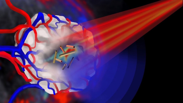 Золотые нанотрубки способны найти и разрушить раковые клетки