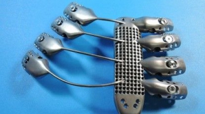 В Испании протезы грудной клетки впервые напечатали на 3D-принтере