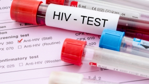 Более половины ВИЧ-инфицированных граждан Молдовы поздно узнают о своем диагнозе