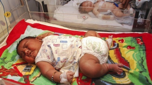 В Индии родился самый крупный в мире ребенок 