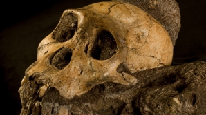 Выяснилось, что предки человека болели раком еще 1,7 млн лет назад