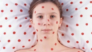 Румынский минздрав предупреждает о вспышке кори: число больных постоянно растет