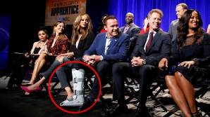 Арнольд Шварценеггер сломал правую ногу