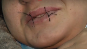 Зачем беженцы в Грузии зашили себе рты