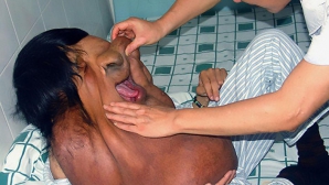 Китайский "Человек-слон" с опухолью на лице отказался участвовать в развлекательном шоу