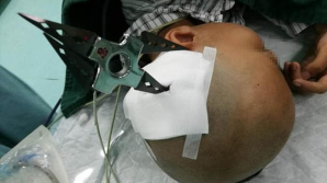 В Китае школьник вонзил звезду ниндзя в голову одноклассницы