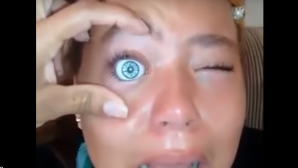 11-летняя девочка вставила себе кукольный глаз и сильно об этом пожалела