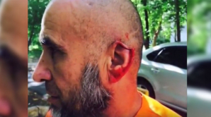 В Москве дворник лишился части уха из-за замечания женщине с собакой