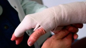 Мужчина получил ожоги рук, пытаясь самостоятельно потушить горящую летнюю кухню