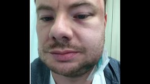 DJ Smash жестоко избили в одном из ночных клубов Перми: видео 