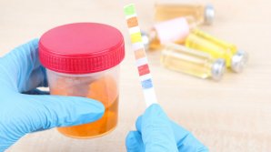 Врачи армянской больницы не отличили анализ мочи от чая