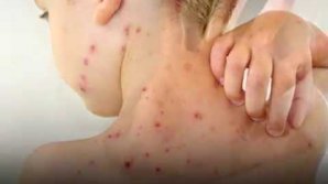 В многодетной семье в селе Копчак корью заболели все 6 детей