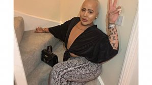 Фанат Кардашьян увеличил ягодицы и получил некроз