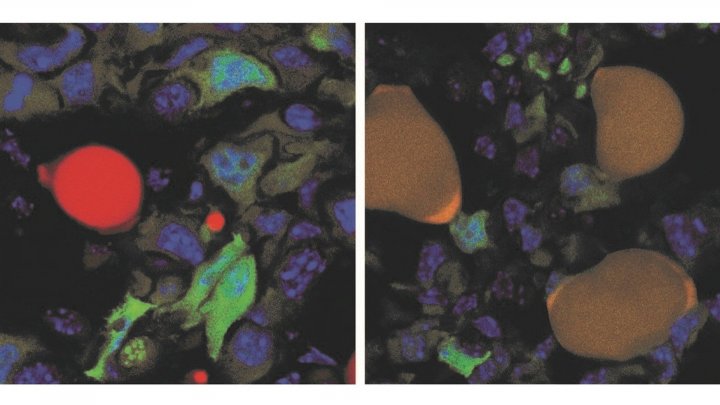Дуэт препаратов остановит рост опухоли, превратив раковые клетки в жировые