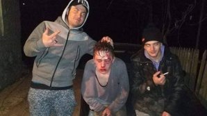 Полиция выяснила обстоятельства жестокого избиения подростка из Чимишлии (видео 18+)