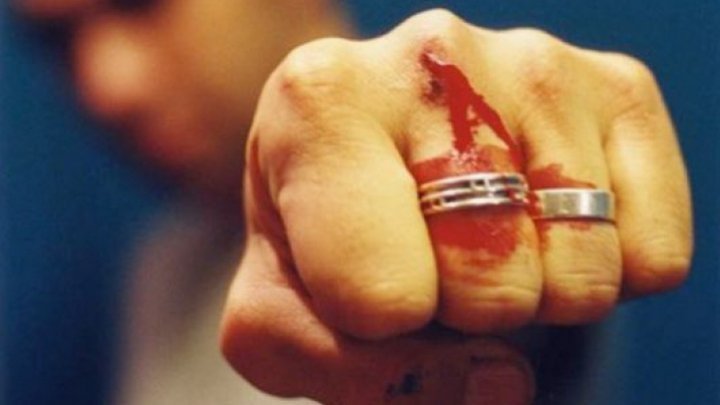 В Кишиневе полицейский применил слезоточивый газ