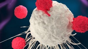 Ученые нашли способ снизить риск развития рака