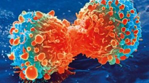 Найден способ заставить клетки организма "поедать" рак
