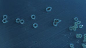 В центральной Африке распространяется штамм сальмонеллы, нечувствительный ко всем существующим лекарствам