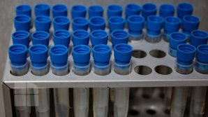 В Испании разработали тест на антитела к коронавирусу с точностью 98%