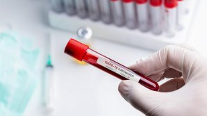 Удар по бухарестскому "Динамо": шесть игроков заразились коронавирусом, двое в больнице