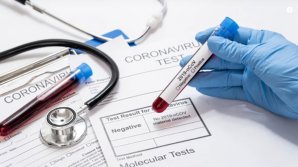 В Молдове незаконно выдано десятки тысяч ковид - сертификатов