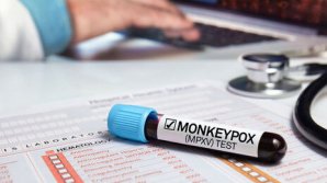 Теперь и у нас! В Молдове зарегистрирован первый случай оспы обезьян