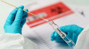 В Молдове снизилось число новых случаев заражения коронавирусом